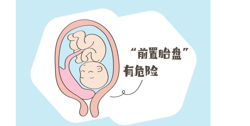 孕期补钙最佳时机与供卵助孕健康指南